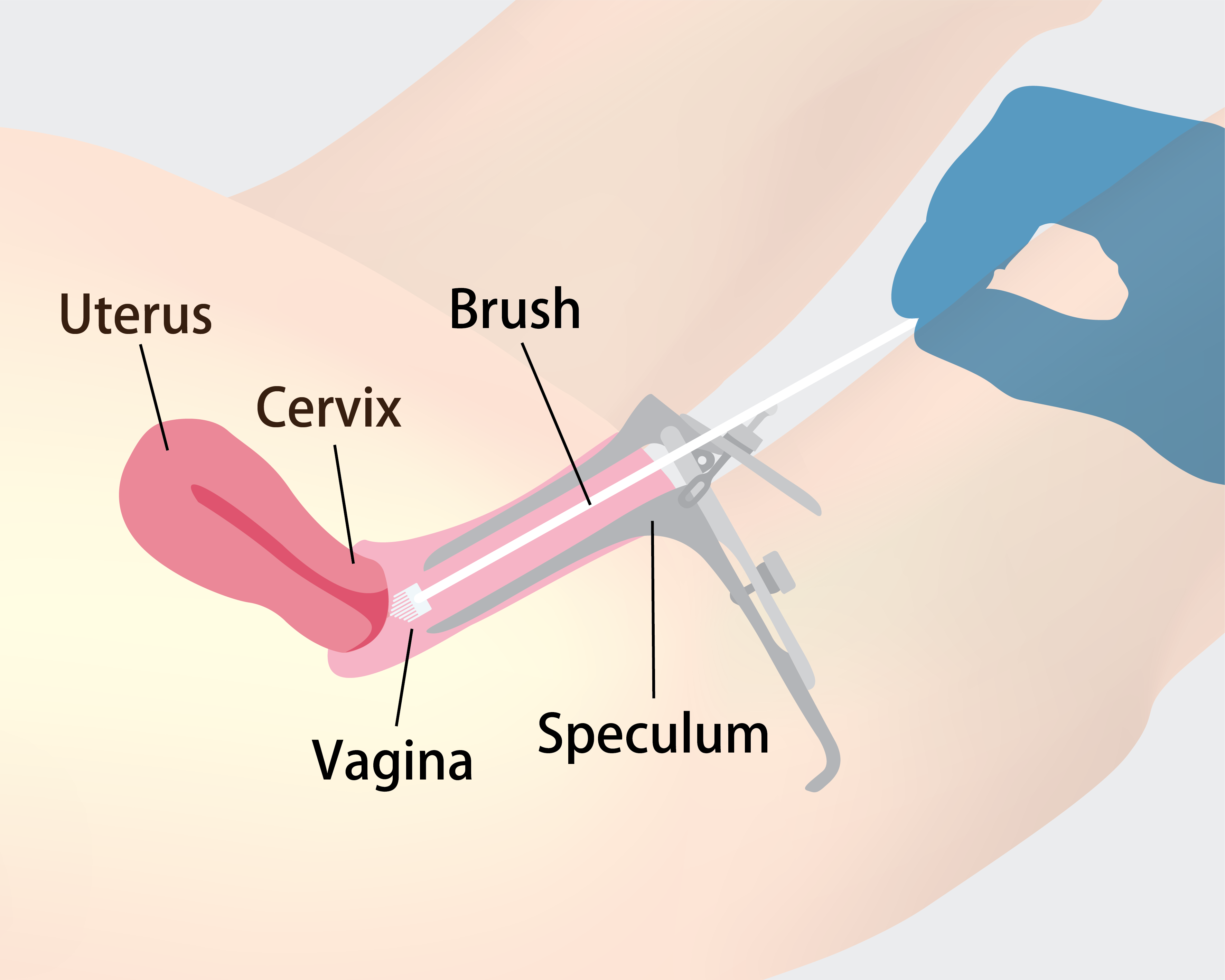 How cervical screening is done